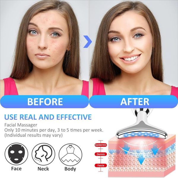 Massager Intense Pulsed Light Wrinkles Reducing Instrument – Esx – Anti Ageing