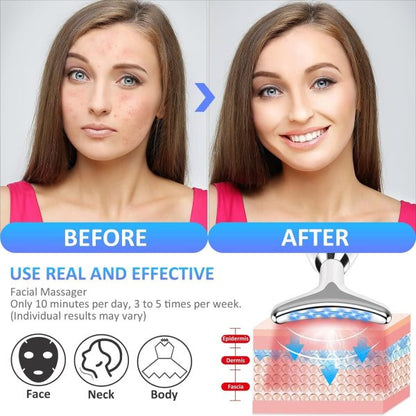 Massager Intense Pulsed Light Wrinkles Reducing Instrument – Esx – Anti Ageing